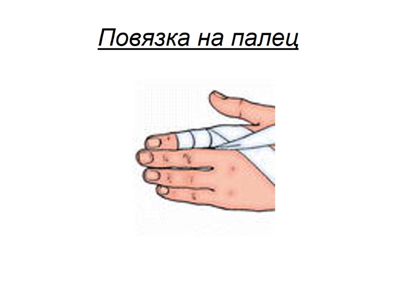 Повязка на палец